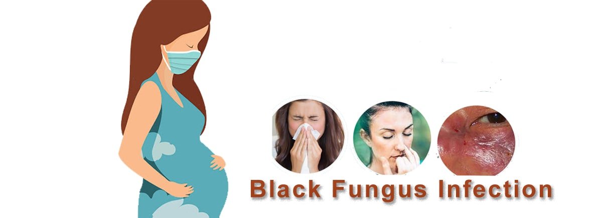 Black Fungus virus, prevent pregnant women from black fungus virus.