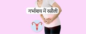 बच्चेदानी में रसौली का इलाज