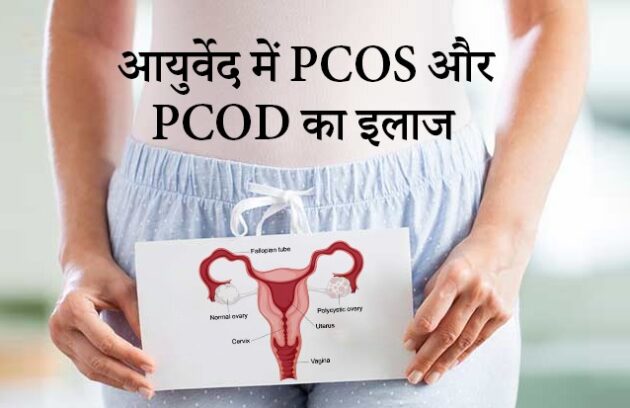 PCOS और PCOD के लिए आयुर्वेदिक इलाज