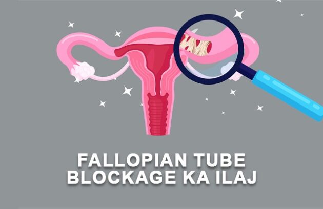 Fallopian Tube Blockage Treatment