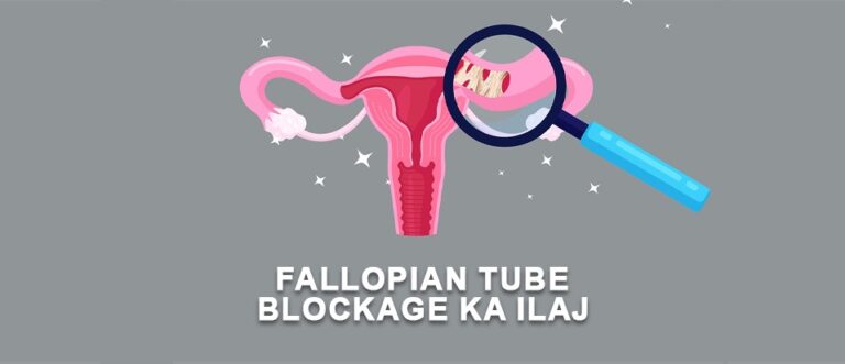 Fallopian Tube Blockage Treatment