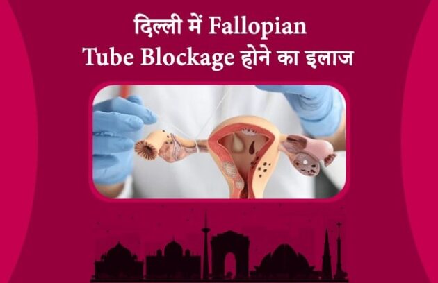 Tubal Blockage Treatment in Delhi